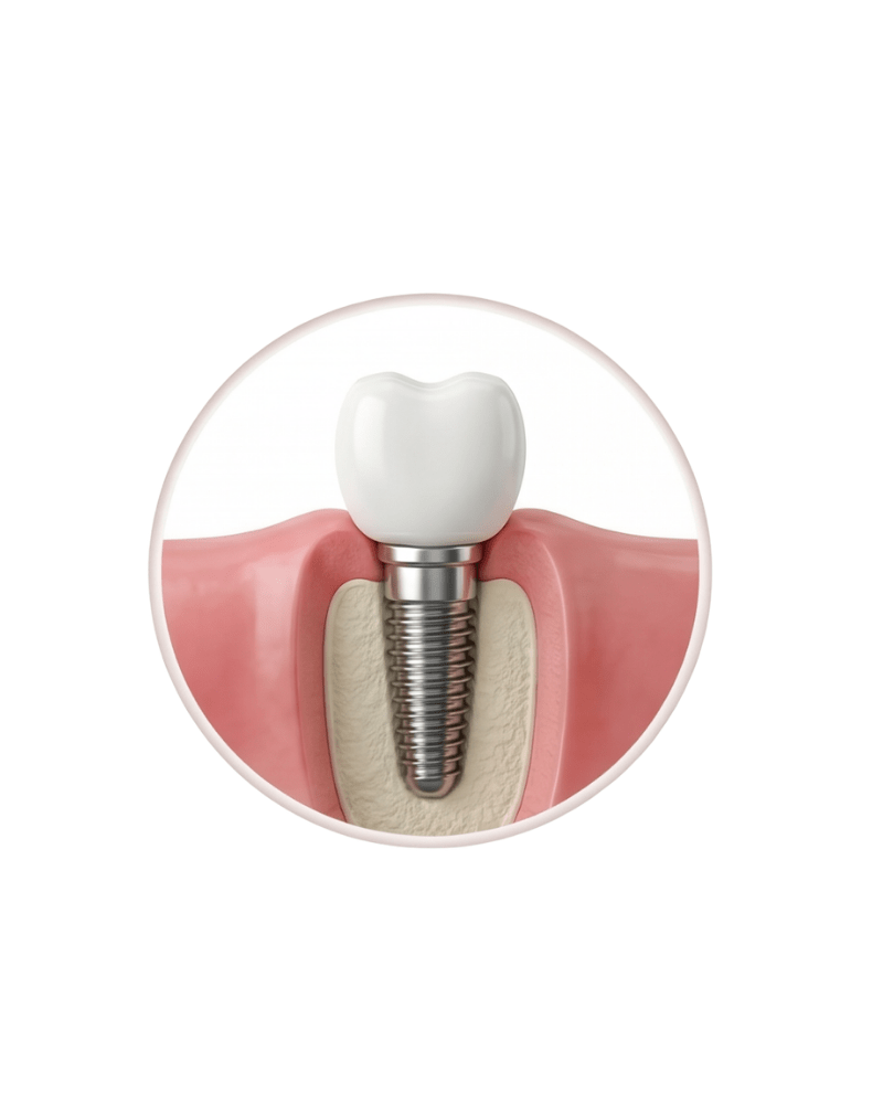 Luresa Rta Lureya Water Flosser - SPECIALIST